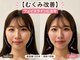 ソラナ(Solana)の写真/たるみ、ホウレイ線でお悩みの方に☆お顔の印象を変えたい方にオススメ♪美容鍼灸でお肌のお悩みを徹底改善