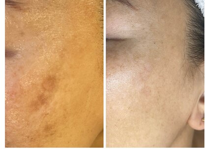 サロン ルテラ(SalonRutella)の写真