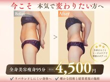キレイサローネ 川越店(KIREI SALONE)