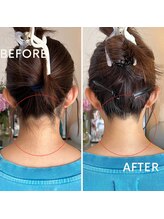 ヒダマリ 新屋敷店(Hidamari)/成人式にうなじ脱毛