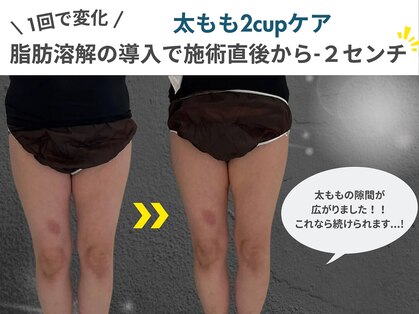 ウナ 福岡店(UNA)の写真