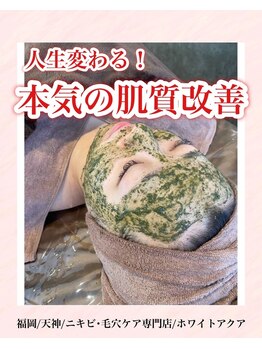 ホワイトアクア 福岡天神店(WHITE AQUA)/ハーブピーリング/ララピール