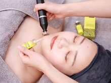 【マイクロウェーブリフトと同時がおすすめ！】レモンボトル