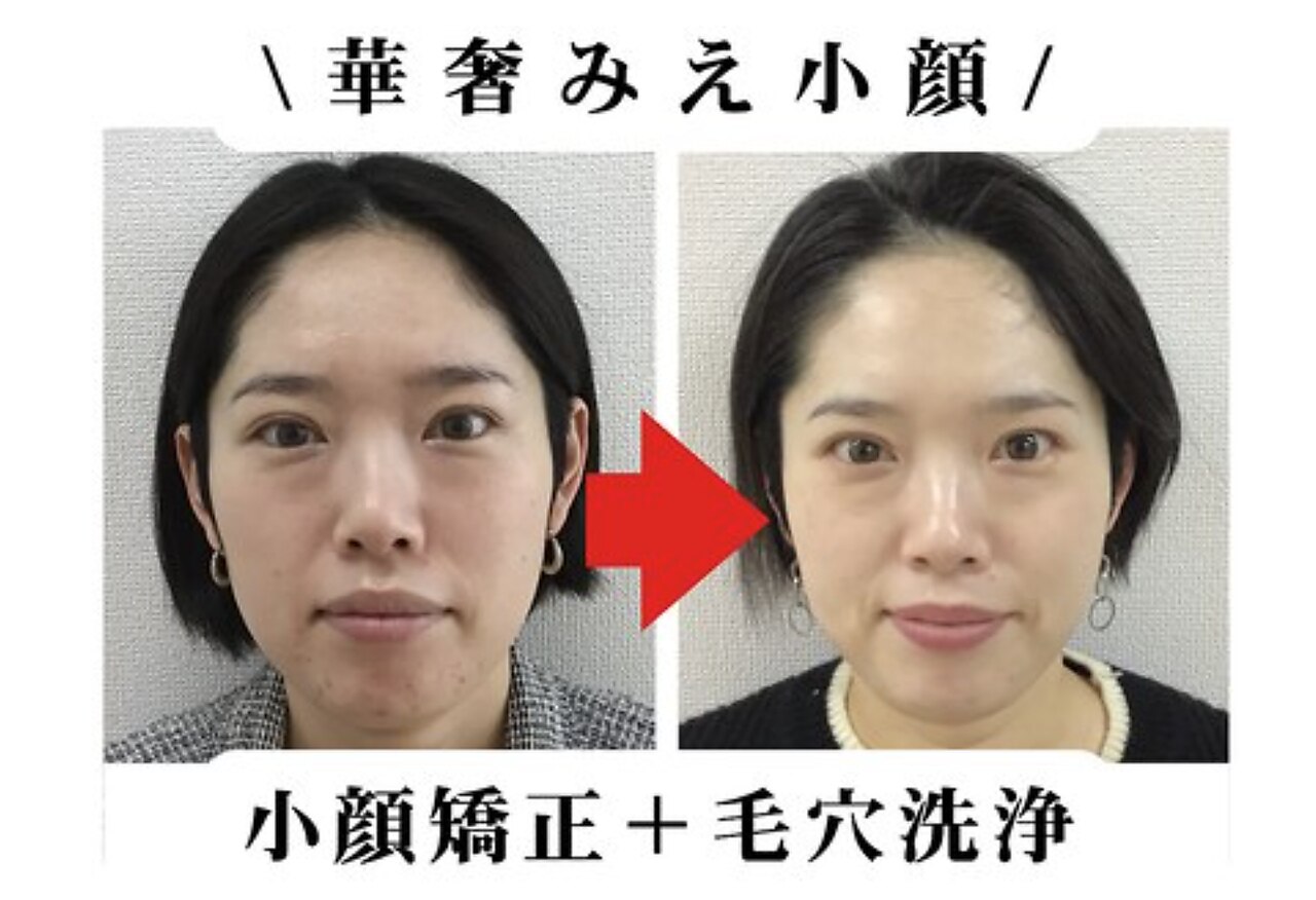 岡山市北区で美肌が人気のエステサロン｜ホットペッパービューティー