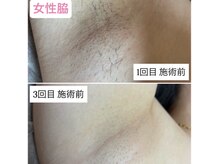 ビューティーサロン マル(Beauty Salon MARU)/