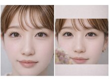 プレ ド セントキュア(pres de st.cure)