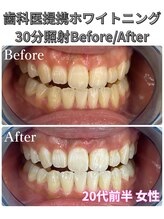 プラチナムビューティ 四条烏丸店(PLATINUM Beauty)/ホワイトニング！Before./After!