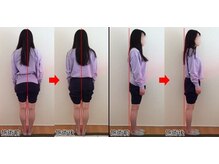 整体院プラス/骨盤矯正モニター