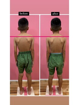 ミリー(mirrie)/子どもも歪んでいいます