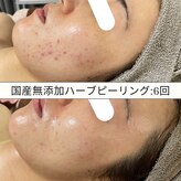 エムリシェ(M.riche)