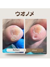 巻き爪補正店 那覇店/