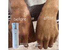 アンジェリークの雰囲気（気になる日焼け対策ハンドもフェイシャルも美白+肌質改善）