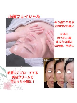 ロビナ(Lovina)/小顔フェイシャル