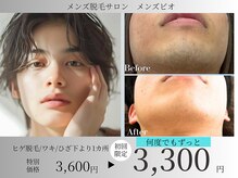 メンズビオ 神戸三宮店の雰囲気（ヒゲ脱毛1回3,300円～都度払いで何度でも自分のペースで通える♪）