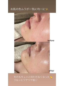 ルアラナ(Lualana)/イラストリアスビフォーアフター