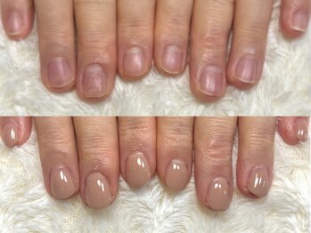 グレースレディ 大阪店/(深爪/長さだし/フィルイン)