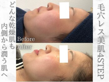 ネオファースト(NeoFirst)の写真/【外苑前駅★徒歩3分】完全都度払いの新しいカタチのエステサロン♪結果重視のトータルビューティーサロン!