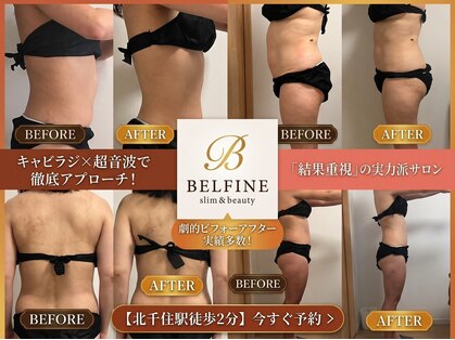 ベルフィーヌ 北千住店(BELFINE)の写真