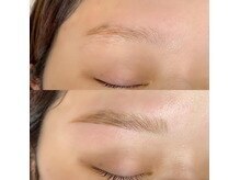 リルモナ(RIREMONA)/