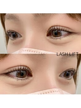 ヴィーナス(Venus)/ラッシュリフト