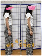 くじら整体院 鍼灸院/猫背、姿勢から改善全身整体