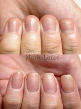 マリーロール 梅田店(Marie Laure)/深爪矯正/自爪育成/自爪風