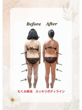 ヨサパーク ジュエル ハビビ 水木店(YOSA PARK JEWEL HABIBI)/お客様の施術後ボディ変化お写真