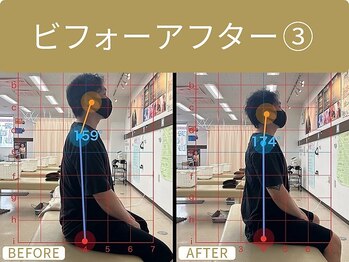 郡山駅西口整体院/ビフォーアフター３