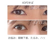 サブリエ(Sablier)