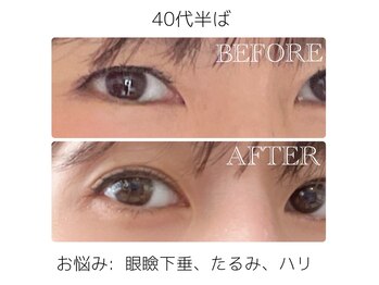 サブリエ(Sablier)