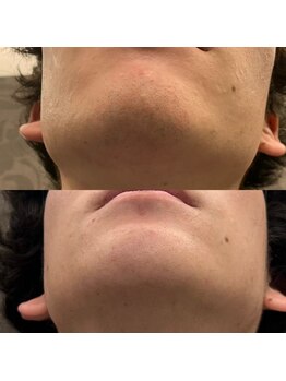 フェリーバ(FELIVA)/お任せください