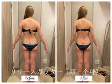 リノ(Lino)/顔＋全身リリースカッター