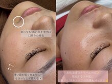 コモレビ(komorebi)/