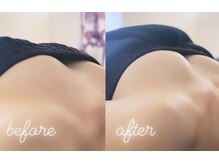 エムプリュ 心斎橋店(M.plus)/バストアッププレミアム1回目