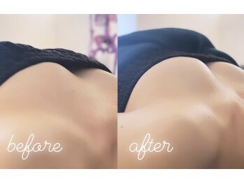 エムプリュ 心斎橋店(M.plus)/バストアッププレミアム1回目