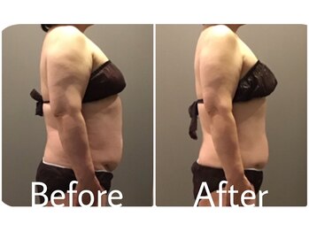 クリスタルビューティー/20回コース