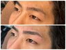 ≪3週間以内の方限定≫ 眉スタ＋HBL＋フェイシャルエステ(美容液込み）