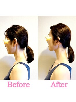 セルフィッシュ(Cellfish)/小顔×美容整体