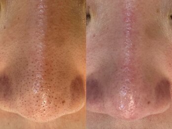 サイセイ(SAISEI)/