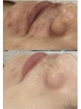 ビジュープラス 筑西下館店(Bijou+)/