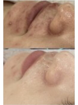 ビジュープラス 筑西下館店(Bijou+)/