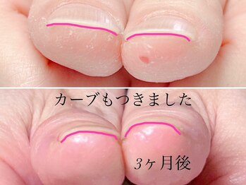 トゥインクリーネイルサロン(Twinkly Nail Salon)/【地爪育成】1回お試し