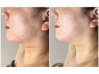 クレビア(CREBIA)/