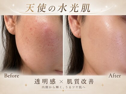 ザ パールズ(The Pearls)の写真