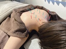 ナウリラックス鍼灸所【美容鍼/肩こり/腰痛/鍼灸/不眠改善/フェイシャル】