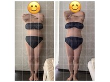 アオ(AO)の雰囲気(落ちにくい脂肪、むくみ、ボディラインの悩みにはセルゼロで!)