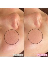 クラルス(clarus)/続ければ続けるほど美肌に変化！