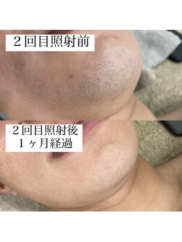 テンパ ビューティー(+10%beauty)/効果写真