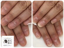 トイロ(toiro)/120分で見た目改善！