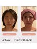 step1【初めての筋層小顔コルギ】口コミ感謝初回特別価格 80分￥5980女性のみ